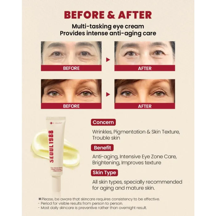 K-Secret Seoul 1988 Eye Cream Retinal Liposome 4% & Fermented Bean 30ml